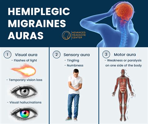 Understanding Complex Hemiplegic Migraine: Symptoms & Treatment