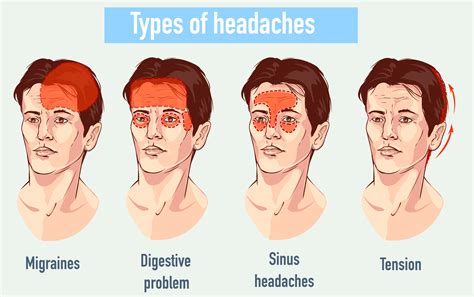 pain on left side of face and back of head